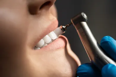 Limpeza Dental